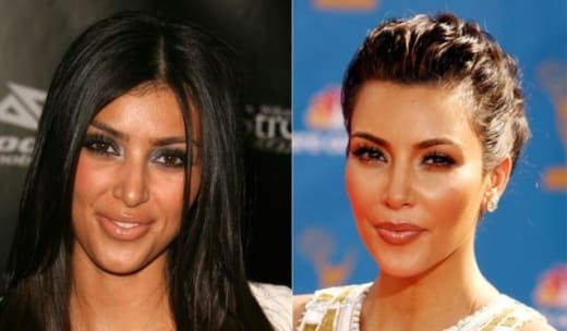 Ким преди и след 1