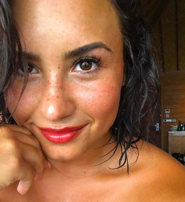 Demi Lovato Freckles
