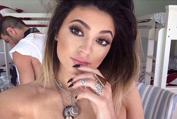 Kylie Jenner: Lippenunterspritzung?