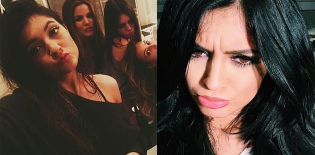 Primerjava ustnic Kylie Jenner